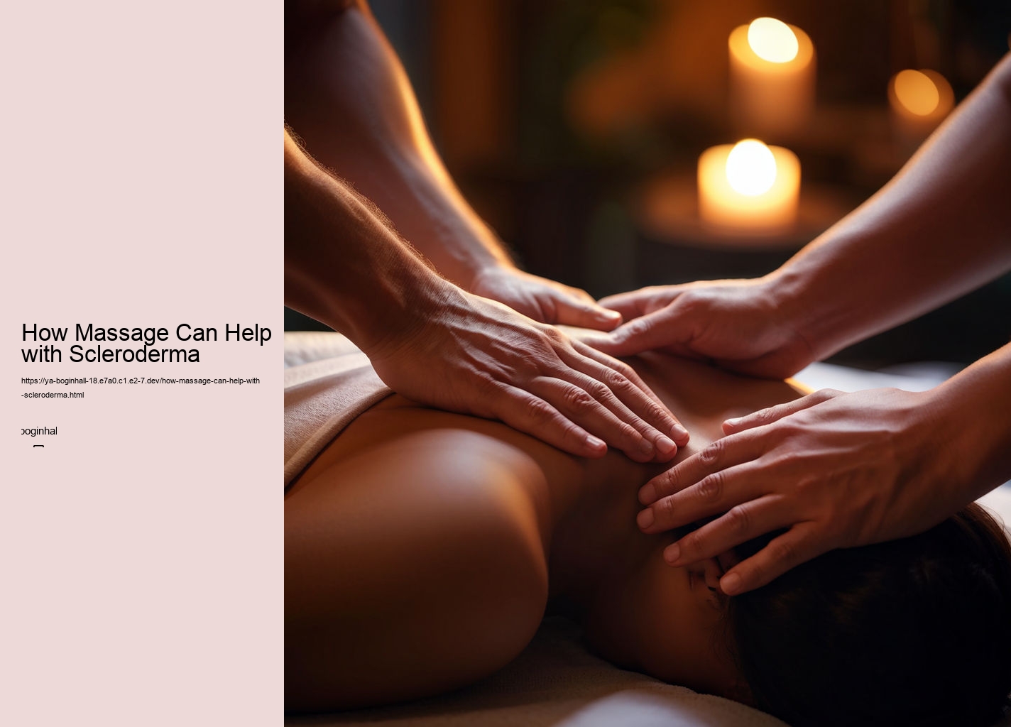 How Massage Can Help with Scleroderma